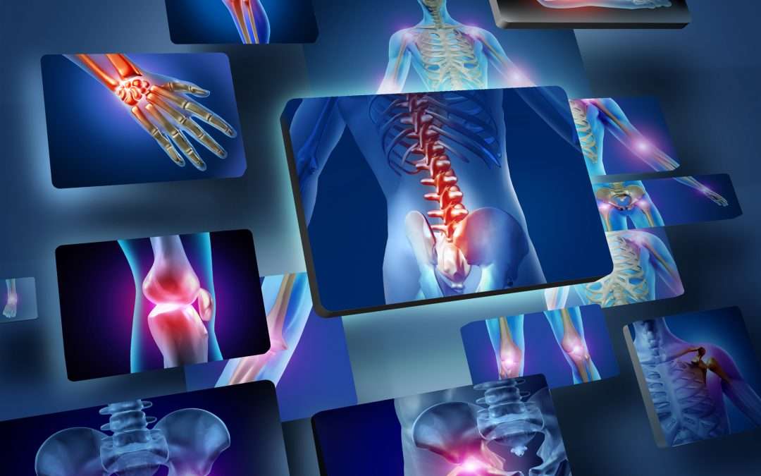 Top Natural Ways to Maintain Strong Bones